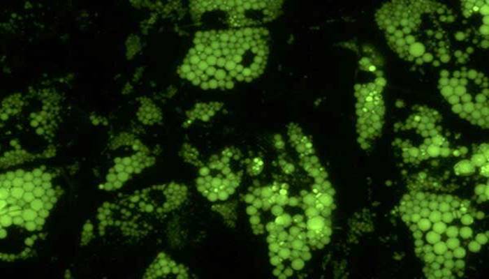 PGRMC2 abre entendimentos sobre obesidade e metabolismo