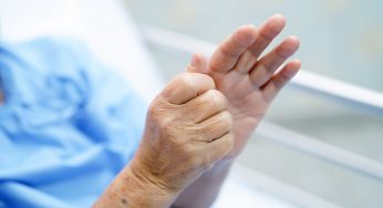 Exame pode detectar a doença de Parkinson antes dos primeiros sintomas