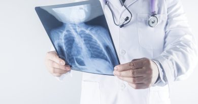 Pesquisadores avaliam efeitos de terapias para embolia pulmonar aguda