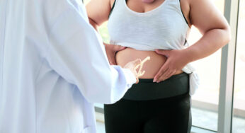 Cirurgia bariátrica pode aumentar o risco de epilepsia